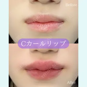 ルラ美容クリニック 郡山院 横瀬 晃平医師の症例