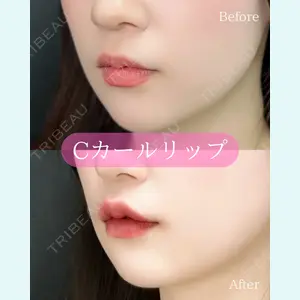 ルラ美容クリニック 郡山院 横瀬 晃平医師の症例