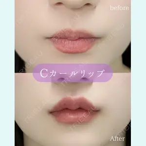 ルラ美容クリニック 郡山院 横瀬 晃平医師の症例