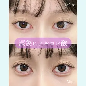 ルラ美容クリニック 郡山院 横瀬 晃平医師の症例