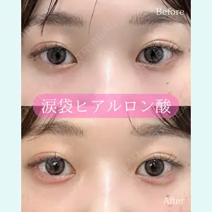 ルラ美容クリニック 郡山院 横瀬 晃平医師の症例