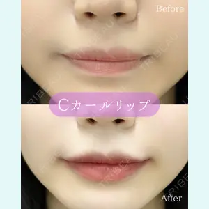 ルラ美容クリニック 郡山院 横瀬 晃平医師の症例