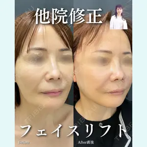 ルラ美容クリニック 渋谷本院 住友 沙織医師の症例