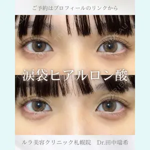 ルラ美容クリニック 札幌本院 田中 瑞希医師の症例