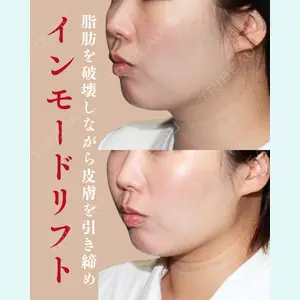 RINGO CLINICの症例