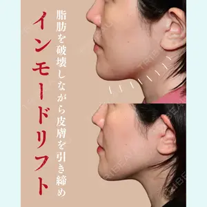 RINGO CLINIC 西田 有加莉医師の症例