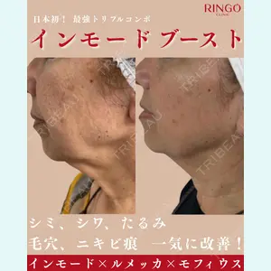 RINGO CLINIC 西田 有加莉医師の症例
