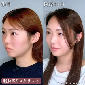 FIG CLINIC 喜多村 勇大朗医師の症例