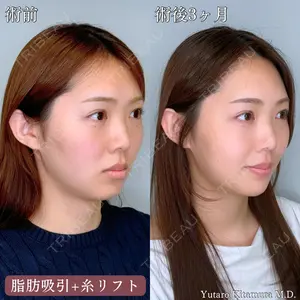 FIG CLINIC 喜多村 勇大朗医師の症例