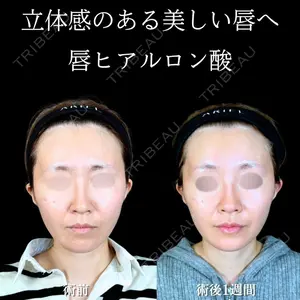 アリエル美容クリニック 大宮院 江郷隼一郎医師の症例