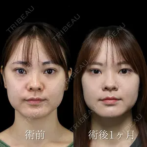 NARU Beauty Clinic 【ナルクリ】 倉津　諭医師の症例