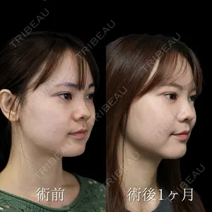 NARU Beauty Clinic 【ナルクリ】 倉津　諭医師の症例