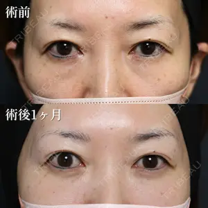 NARU Beauty Clinic 【ナルクリ】 石橋 成彦医師の症例