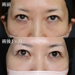 NARU Beauty Clinic 【ナルクリ】 石橋 成彦医師の症例