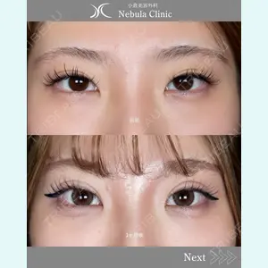 小倉美容外科ネビュラクリニック 浦野 正樹医師の症例