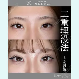 小倉美容外科ネビュラクリニック 浦野 正樹医師の症例