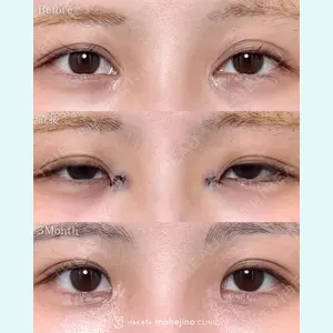 博多もへじのクリニック 村田 将光医師の症例