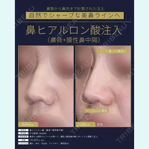 聖心美容クリニック 広島院 中辻 隆徳医師の症例