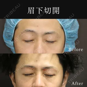 東京ココセランクリニック 篠﨑 智公医師の症例