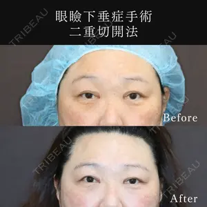 東京ココセランクリニック 篠﨑 智公医師の症例