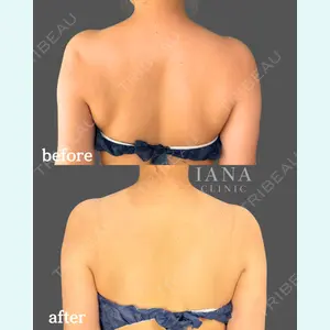 IANA CLINIC 穴井 元康医師の症例