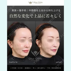 Otus Clinic 【オータスクリニック】 中 徳太郎医師の症例