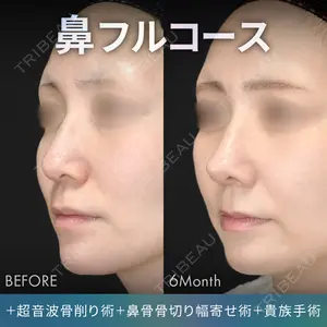 ジョウクリニック 銀座院 重本　譲医師の症例