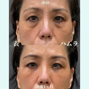 お茶の水美容形成クリニック 吉井 健吾医師の症例