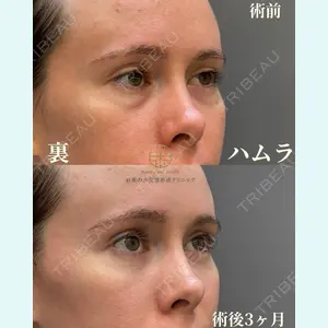 お茶の水美容形成クリニック 吉井 健吾医師の症例