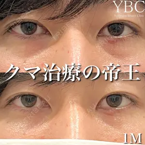 YBC横浜美容外科 大宮院 磯村 亮輔医師の症例