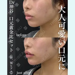 EMMO FACE CLINIC 大阪梅田院 神谷 一成医師の症例