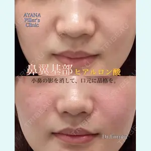 AYANAフィラーズクリニック 渋谷院 古田 晃医師の症例