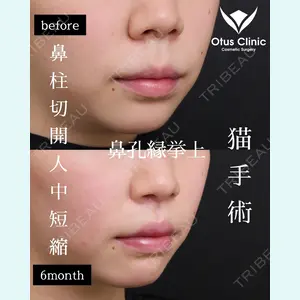 Otus Clinic 【オータスクリニック】 中 徳太郎医師の症例