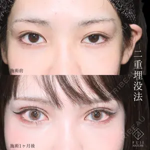 藤・ナチュレ美容クリニック 銀座院 小川 杏平医師の症例