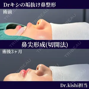 ネビュラクリニック 京都院 岸 大輔医師の症例