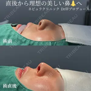 ネビュラクリニック 京都院 岸 大輔医師の症例