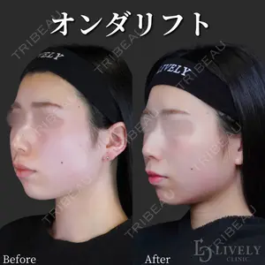 ライブリークリニック 大阪院の症例