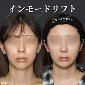 ライブリークリニック 大阪院の症例