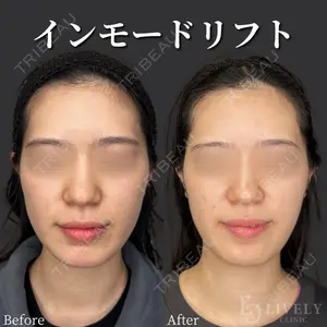 ライブリークリニック 大阪院の症例