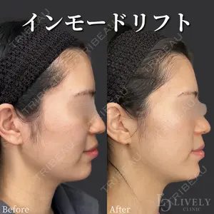 ライブリークリニック 大阪院の症例