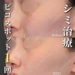 ライブリークリニック 浜松町院 林 政男医師の症例