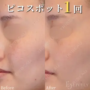 ライブリークリニック 浜松町院 林 政男医師の症例