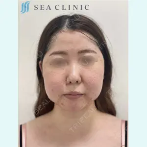 SEA CLINIC（シークリニック） 沼澤 茂医師の症例