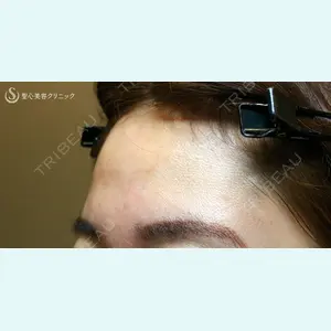 聖心美容クリニック 札幌院 前多 一彦医師の症例