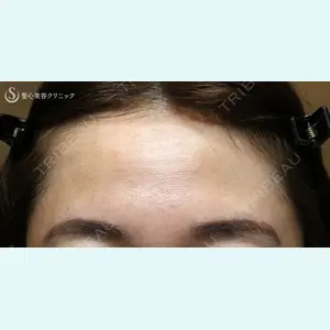聖心美容クリニック 札幌院 前多 一彦医師の症例