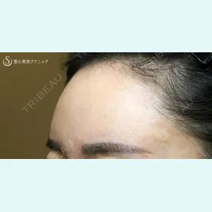 聖心美容クリニック 札幌院 前多 一彦医師の症例