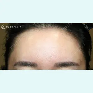 聖心美容クリニック 札幌院 前多 一彦医師の症例