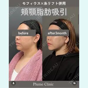 plume clinic 向山 綾子医師の症例
