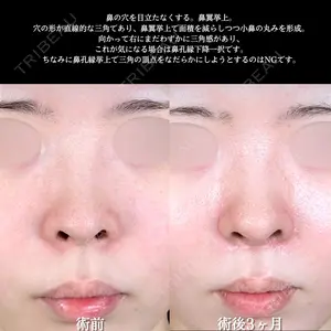 アリエル美容クリニック 大宮院 阪野 一世医師の症例