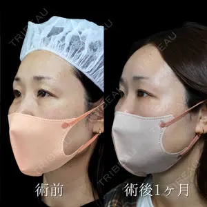 NARU Beauty Clinic 【ナルクリ】 倉津　諭医師の症例